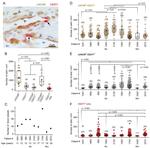 CD271 (NGF Receptor) Antibody in Immunohistochemistry (Paraffin) (IHC (P))