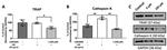 Tartrate Resistant Acid Phosphatase Antibody in Western Blot (WB)