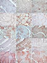 VDR Antibody in Immunohistochemistry (PFA fixed) (IHC (PFA))