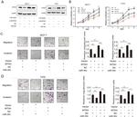 Metadherin Antibody in Western Blot (WB)