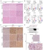 GFAP Antibody in Western Blot (WB)