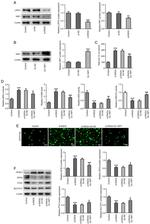 ACSL4 Antibody in Western Blot (WB)