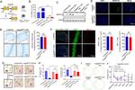 betatrophin Antibody in Western Blot (WB)
