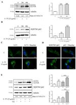 SQSTM1 Antibody in Western Blot (WB)