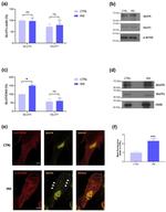 GLUT4 Antibody in Western Blot (WB)