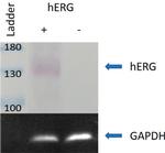 KCNH2 Antibody in Western Blot (WB)