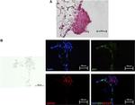Gata-3 Antibody in Immunohistochemistry (Paraffin) (IHC (P))