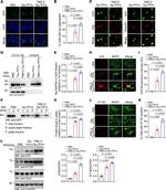 Tau Antibody in Western Blot (WB)