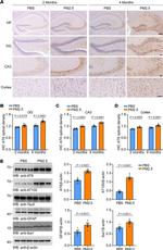Tau Antibody in Western Blot, Immunohistochemistry (WB, IHC)