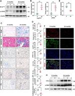 p16INK4a Antibody in Western Blot, Immunohistochemistry (WB, IHC)