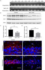 HRD1 Antibody in Western Blot (WB)