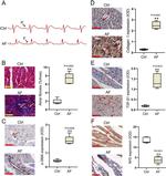 Nrf2 Antibody in Immunohistochemistry (Paraffin) (IHC (P))