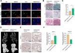 Aggrecan Neo Antibody in Immunohistochemistry (IHC)