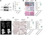 Aggrecan Neo Antibody in Immunohistochemistry (IHC)