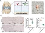 Aggrecan Neo Antibody in Immunohistochemistry (IHC)