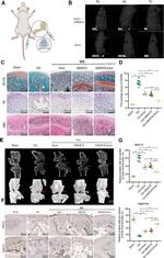 Aggrecan Neo Antibody in Immunohistochemistry (IHC)
