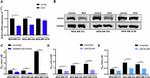 ACSL4 Antibody in Western Blot (WB)
