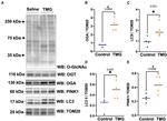 O-linked N-acetylglucosamine (O-GlcNAc) Antibody in Western Blot (WB)