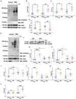 O-linked N-acetylglucosamine (O-GlcNAc) Antibody in Western Blot (WB)
