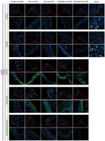 Chromogranin A Antibody in Immunohistochemistry (Paraffin) (IHC (P))