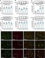 ACVR1 Antibody in Western Blot (WB)
