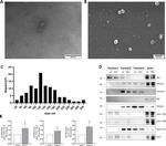 TSG101 Antibody in Western Blot (WB)