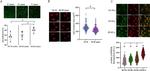 p16INK4a Antibody in Immunohistochemistry (PFA fixed) (IHC (PFA))