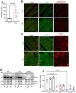 IGFBP7 Antibody in Western Blot (WB)
