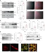 IGFBP7 Polyclonal Antibody