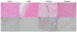 HIF1A Antibody in Immunohistochemistry (PFA fixed) (IHC (PFA))