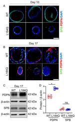 Podoplanin Antibody in Western Blot (WB)