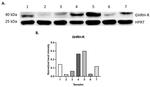 GHRHR Antibody in Western Blot (WB)