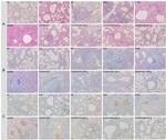 MUC5AC Antibody in Immunohistochemistry (Paraffin) (IHC (P))
