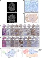 CD31 Antibody in Immunohistochemistry (PFA fixed) (IHC (PFA))