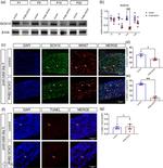 Ki-67 Antibody in Immunohistochemistry (IHC)