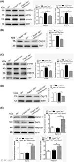 HERPUD1 Antibody in Western Blot (WB)