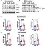LOXL1 Antibody in Western Blot (WB)