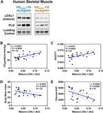 LOXL1 Antibody in Western Blot (WB)