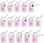TGM2 Antibody in Western Blot, Immunoprecipitation (WB, IP)