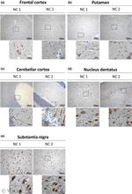 NSE Antibody in Immunohistochemistry (IHC)