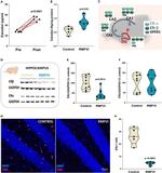 Estrogen Receptor beta Antibody in Western Blot (WB)