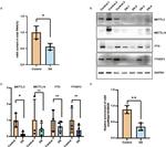 METTL3 Antibody in Western Blot (WB)
