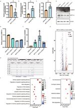 METTL3 Monoclonal Antibody (OTI1B7)