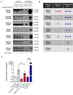 PPARGC1A Antibody in Western Blot (WB)