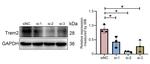 TREM2 Antibody in Western Blot (WB)