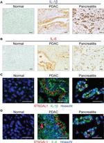 IL-1 beta Antibody in Immunohistochemistry (Paraffin) (IHC (P))