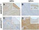 AKR1C2 Antibody in Immunohistochemistry (Paraffin) (IHC (P))