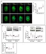 SEMA3A Antibody in Western Blot (WB)