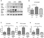 IFN gamma Antibody in Western Blot (WB)