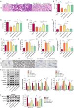 WNK1 Antibody in Western Blot (WB)